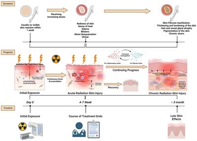 Deciphering the fibrotic process: mechanism of chronic radiation skin injury fibrosis